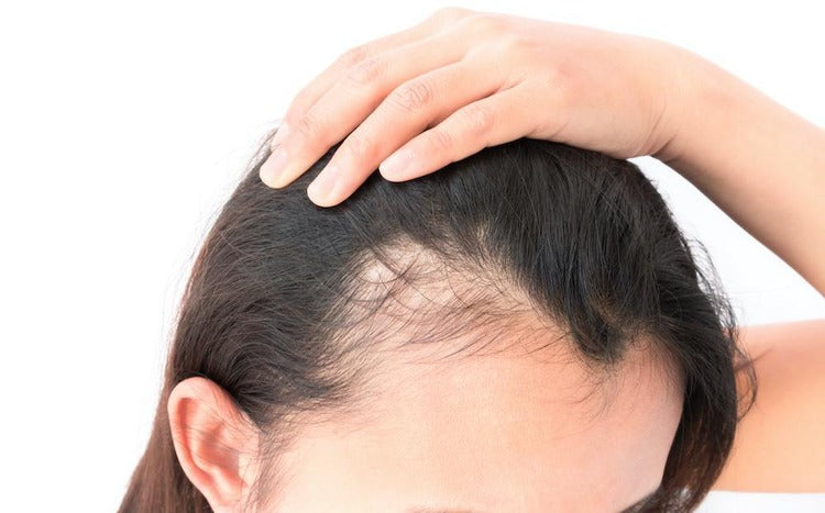 Diabetes and hair loss